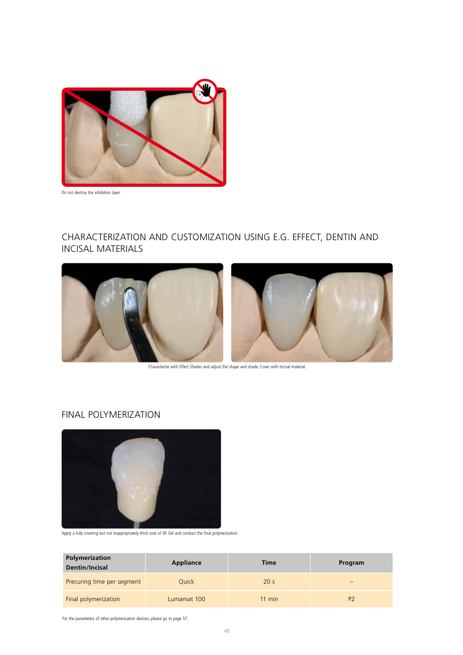 Ivoclar Vivadent SR Nexco Paste User Manual | Page 48 / 64