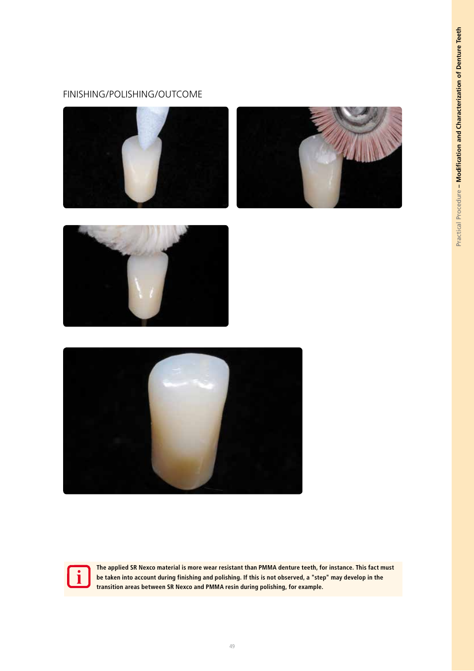 Finishing/polishing/outcome | Ivoclar Vivadent SR Nexco Paste User Manual | Page 49 / 64