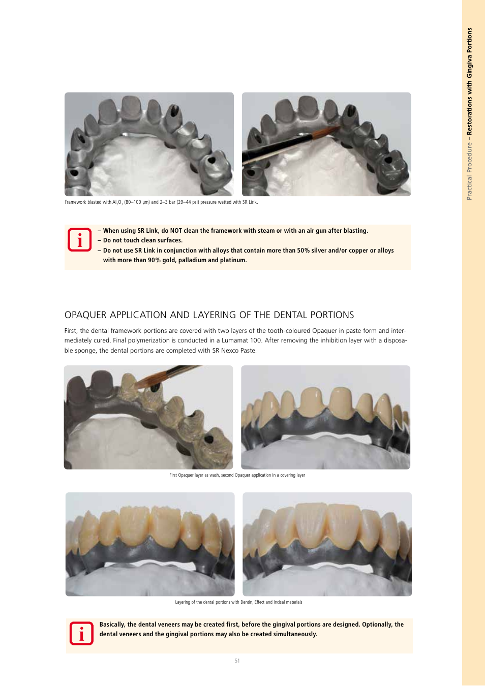 Ivoclar Vivadent SR Nexco Paste User Manual | Page 51 / 64
