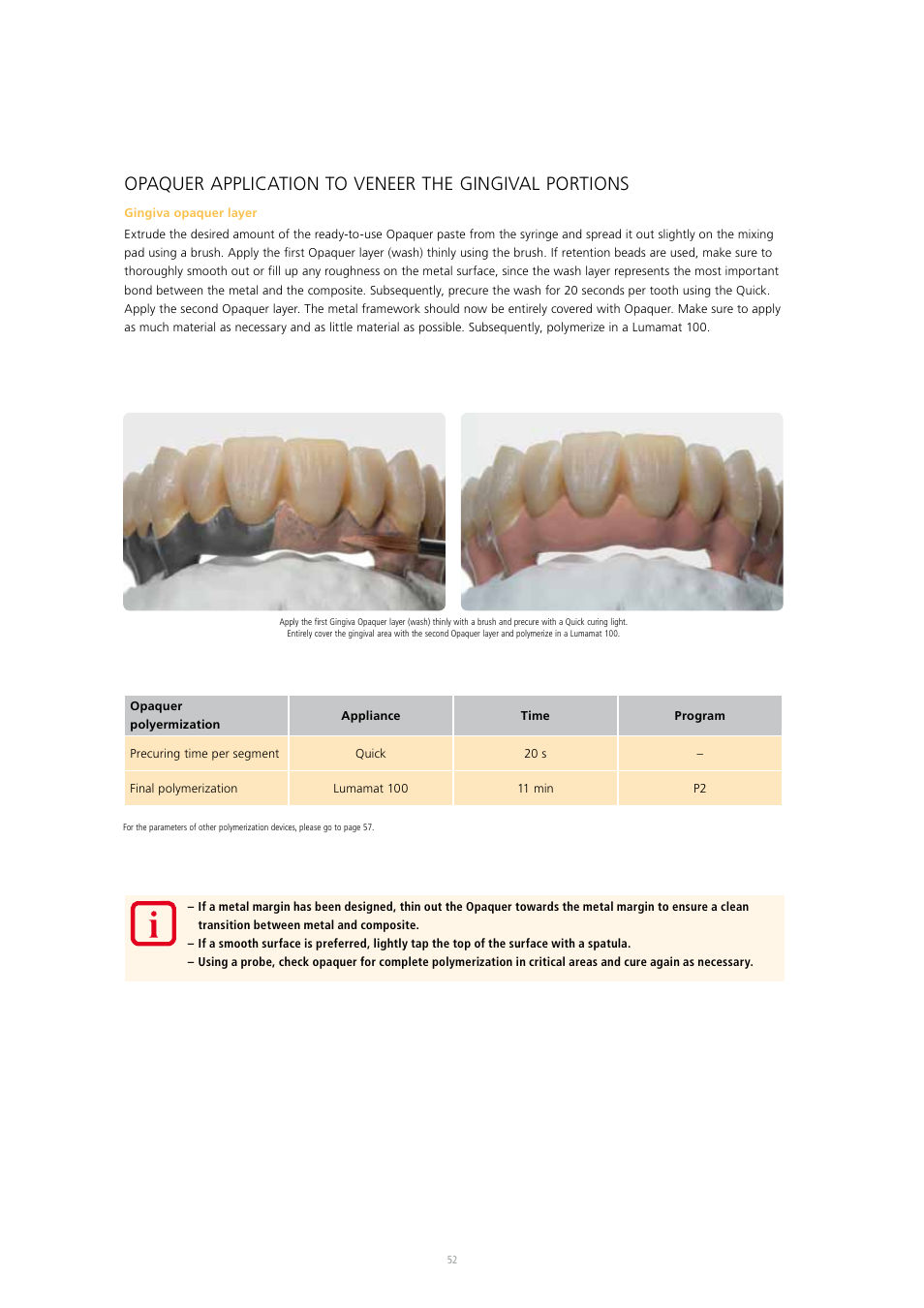 Ivoclar Vivadent SR Nexco Paste User Manual | Page 52 / 64