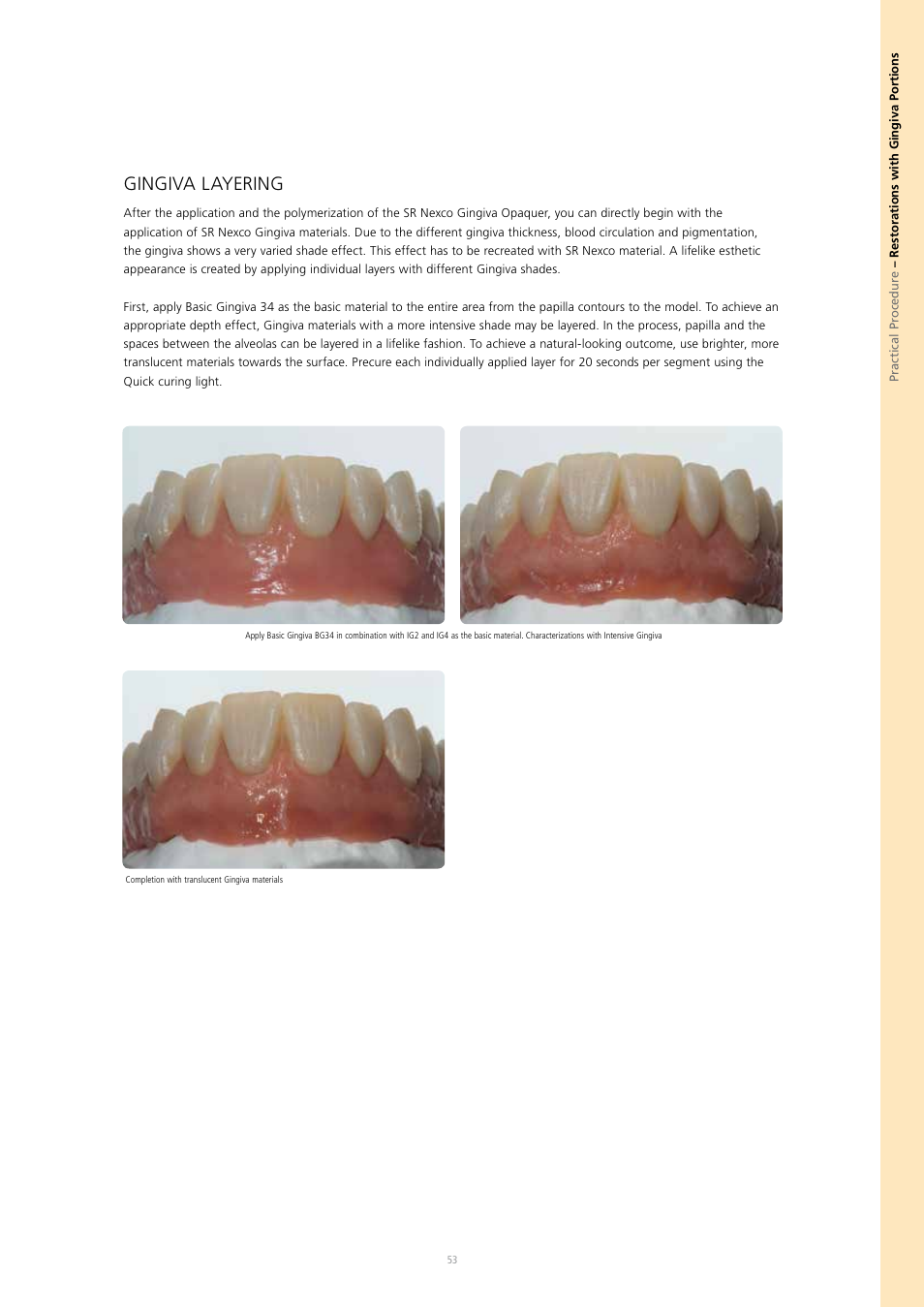 Gingiva layering | Ivoclar Vivadent SR Nexco Paste User Manual | Page 53 / 64