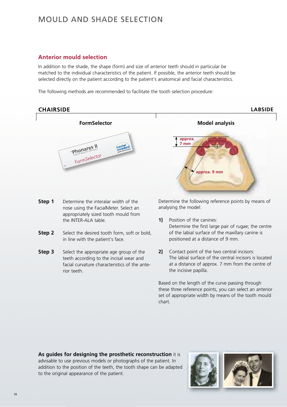 Mould and shade selection, Anterior mould selection, Chairside | Ivoclar Vivadent SR Phonares II User Manual | Page 10 / 40