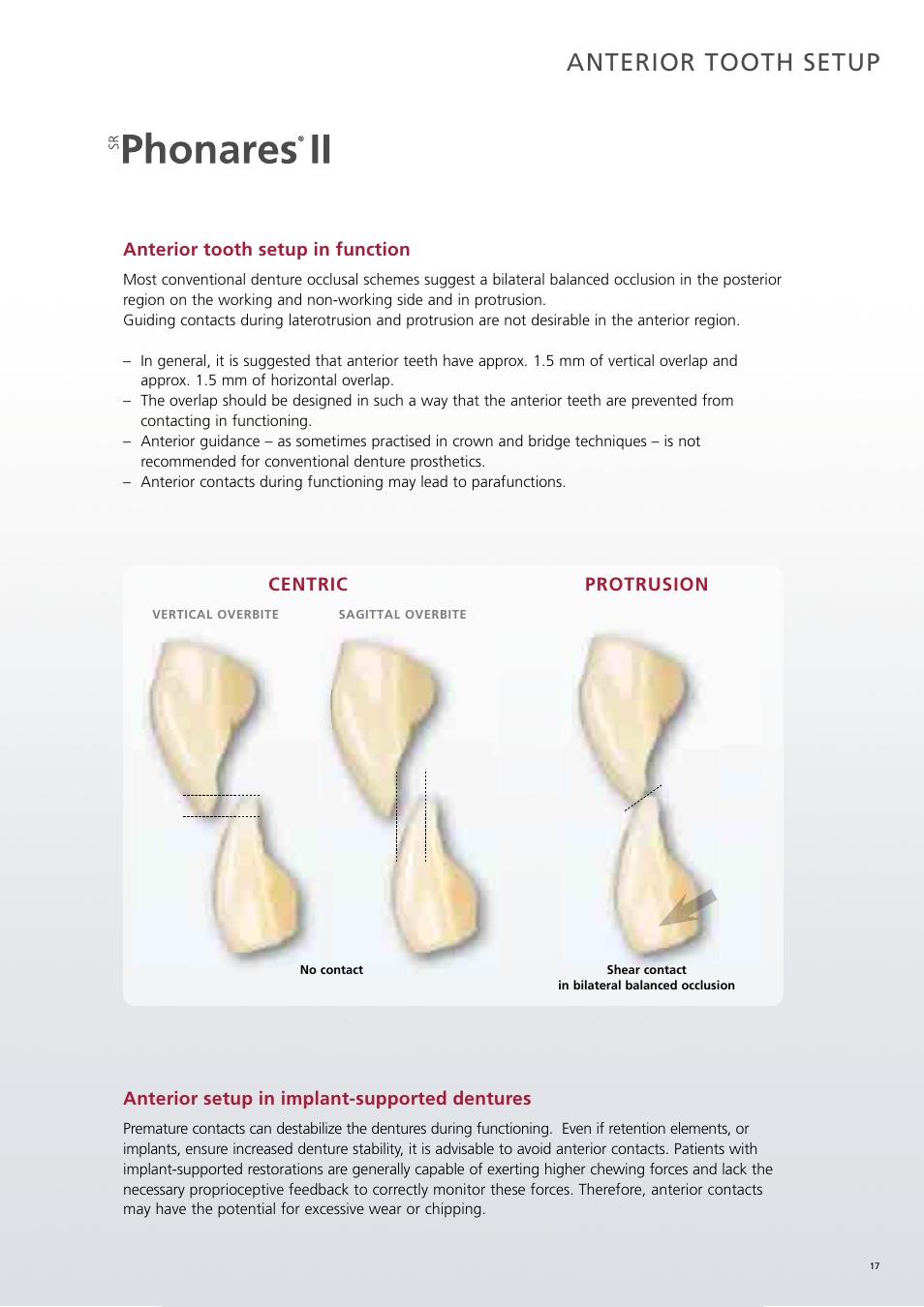 Anterior tooth setup | Ivoclar Vivadent SR Phonares II User Manual | Page 17 / 40