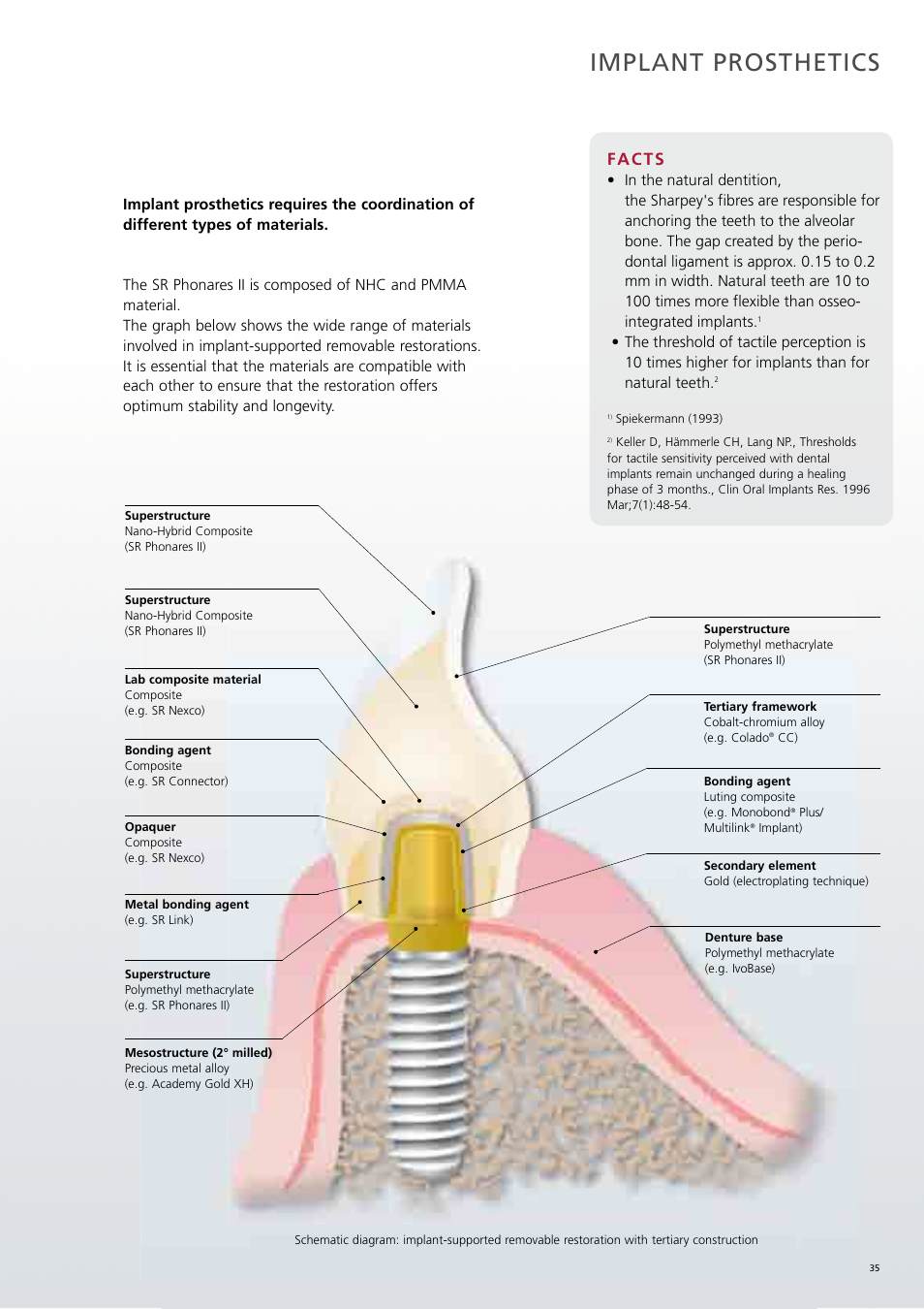 Implant prosthetics, Facts | Ivoclar Vivadent SR Phonares II User Manual | Page 35 / 40