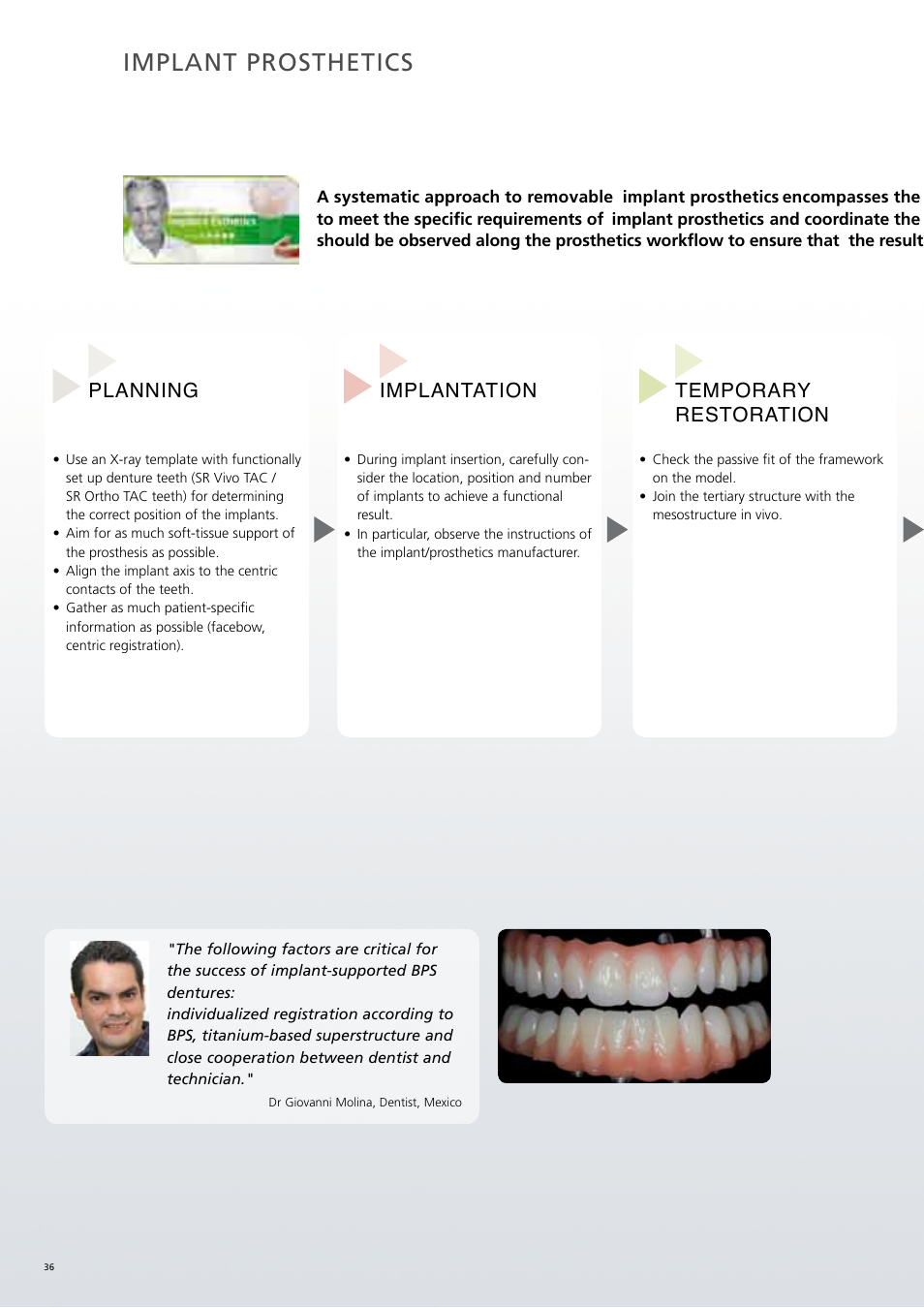 Implant prosthetics, Temporary restoration implantation planning | Ivoclar Vivadent SR Phonares II User Manual | Page 36 / 40