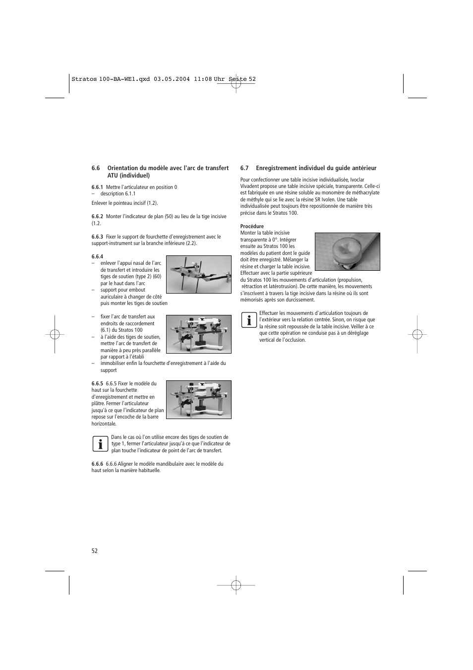 Ivoclar Vivadent Stratos 100 User Manual | Page 52 / 92