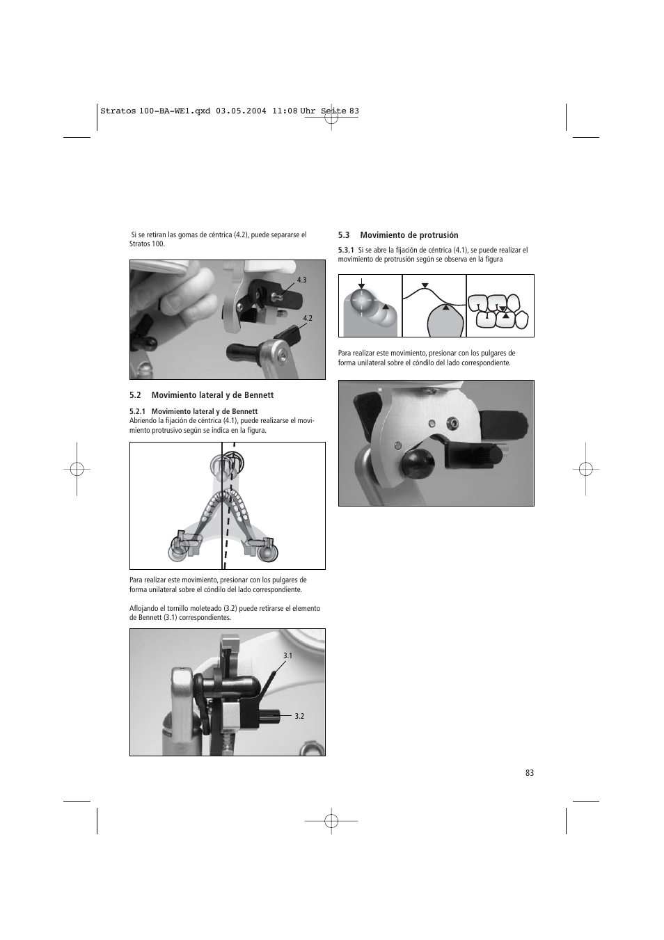 Ivoclar Vivadent Stratos 100 User Manual | Page 83 / 92