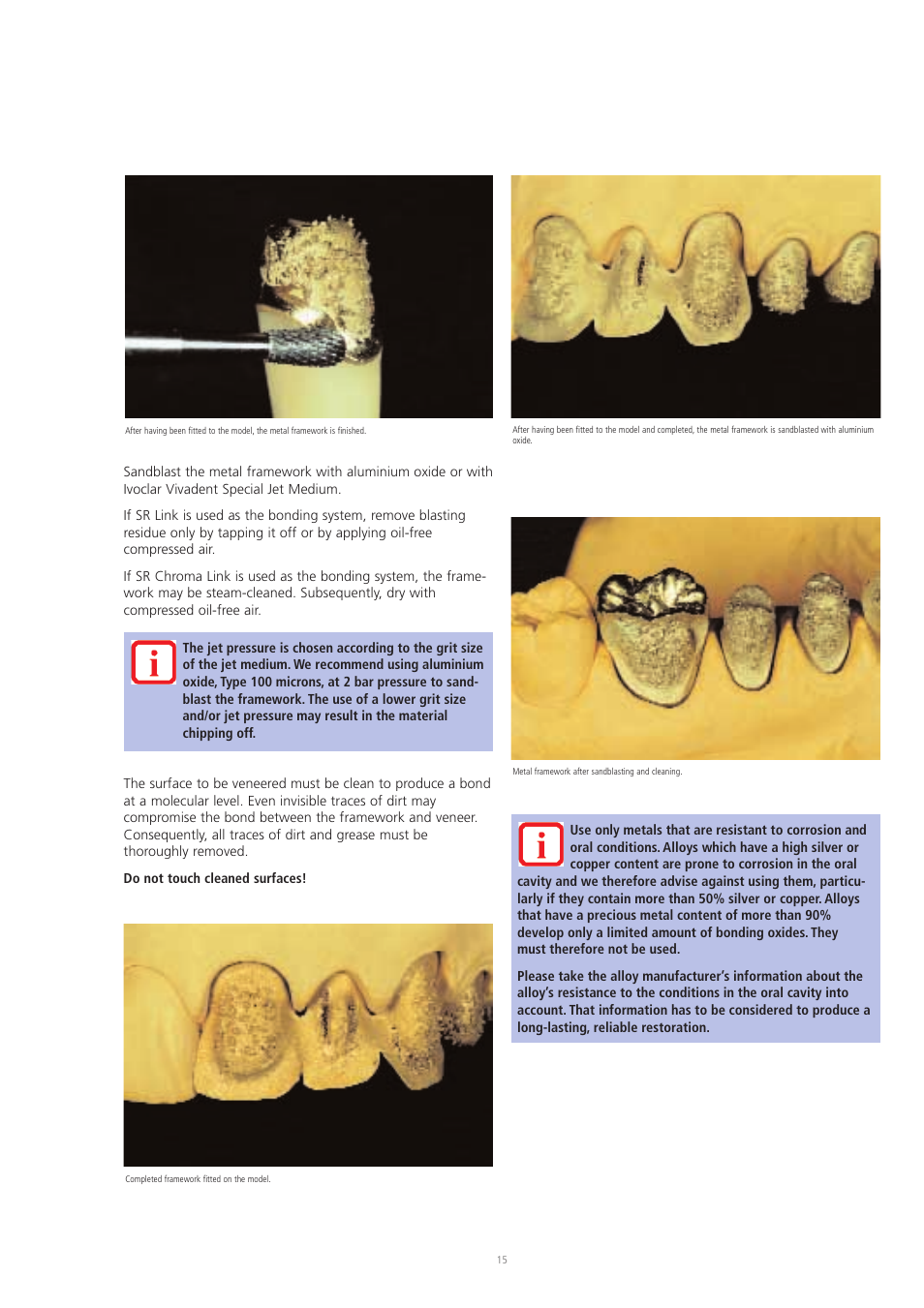 Ivoclar Vivadent SR Chromasit User Manual | Page 15 / 28