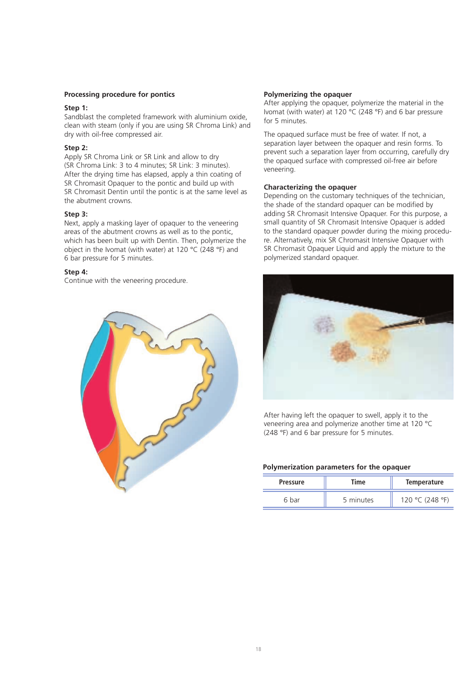 Ivoclar Vivadent SR Chromasit User Manual | Page 18 / 28