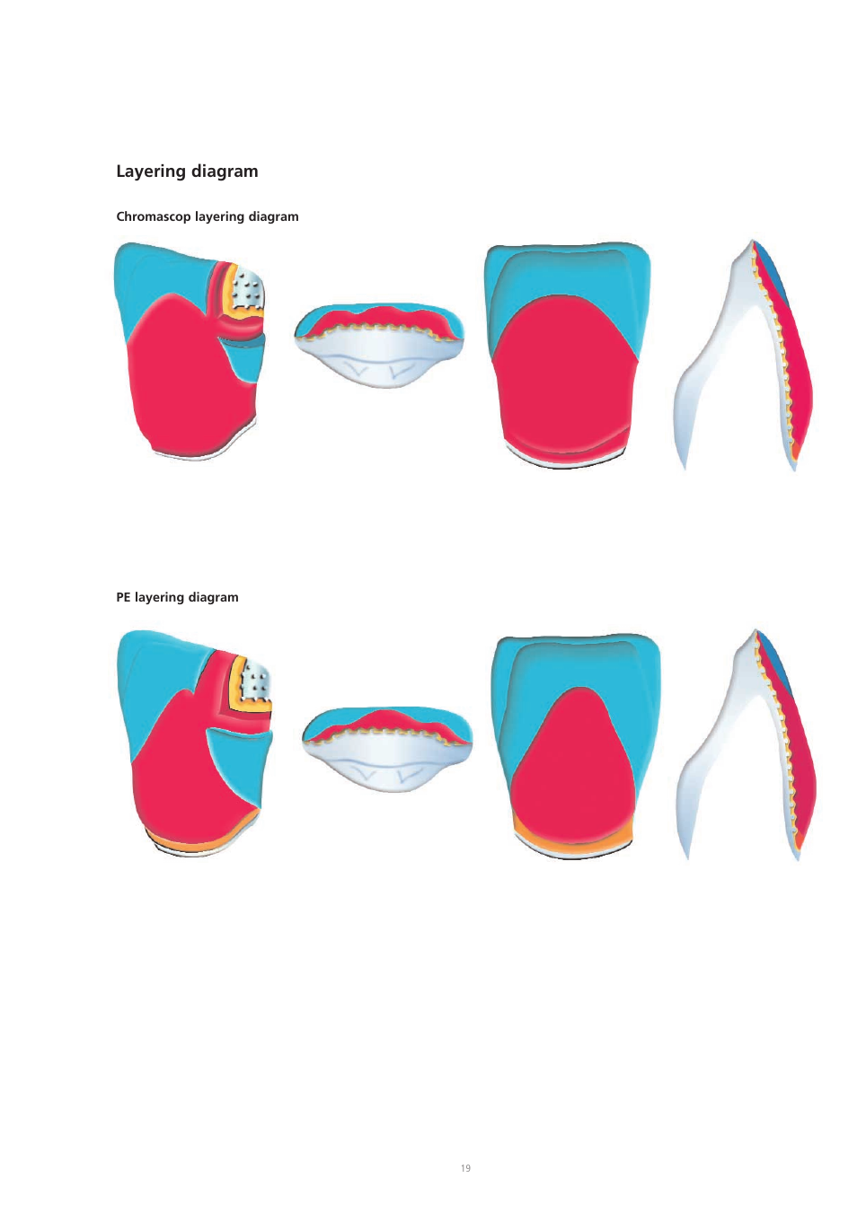Layering diagram | Ivoclar Vivadent SR Chromasit User Manual | Page 19 / 28
