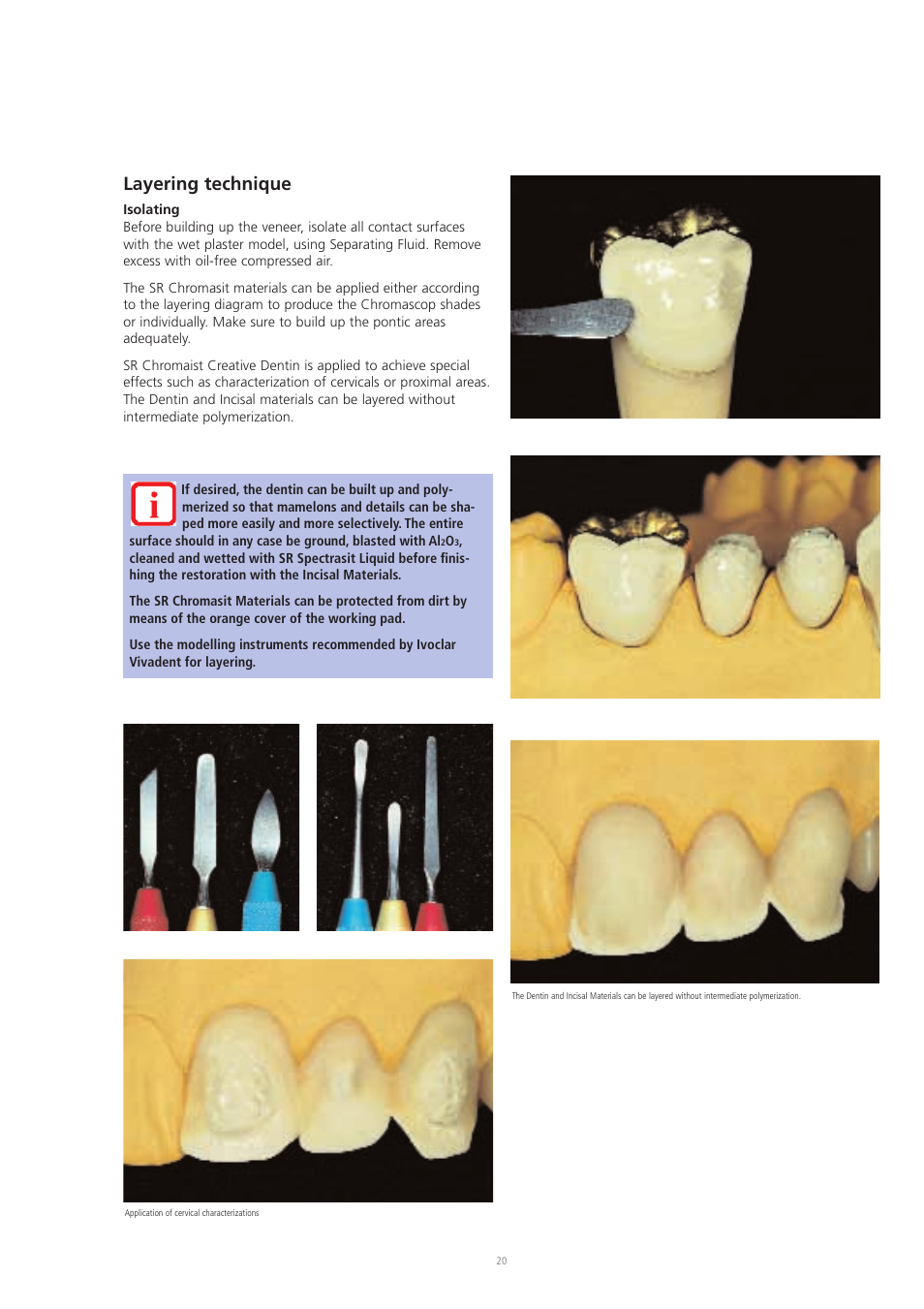 Layering technique | Ivoclar Vivadent SR Chromasit User Manual | Page 20 / 28