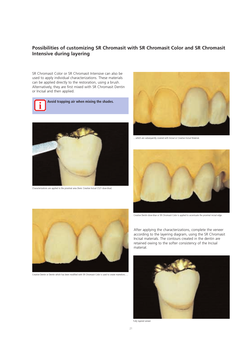 Ivoclar Vivadent SR Chromasit User Manual | Page 21 / 28