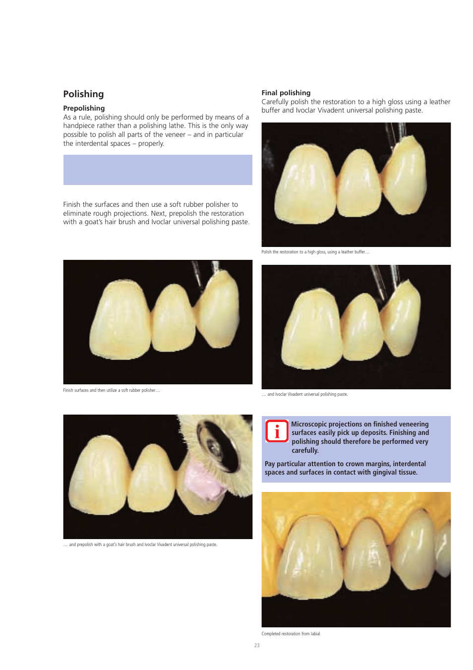 Polishing | Ivoclar Vivadent SR Chromasit User Manual | Page 23 / 28