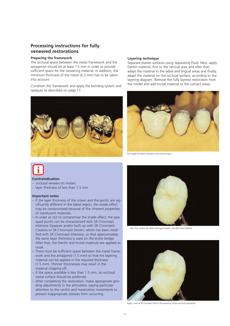 Ivoclar Vivadent SR Chromasit User Manual | Page 24 / 28
