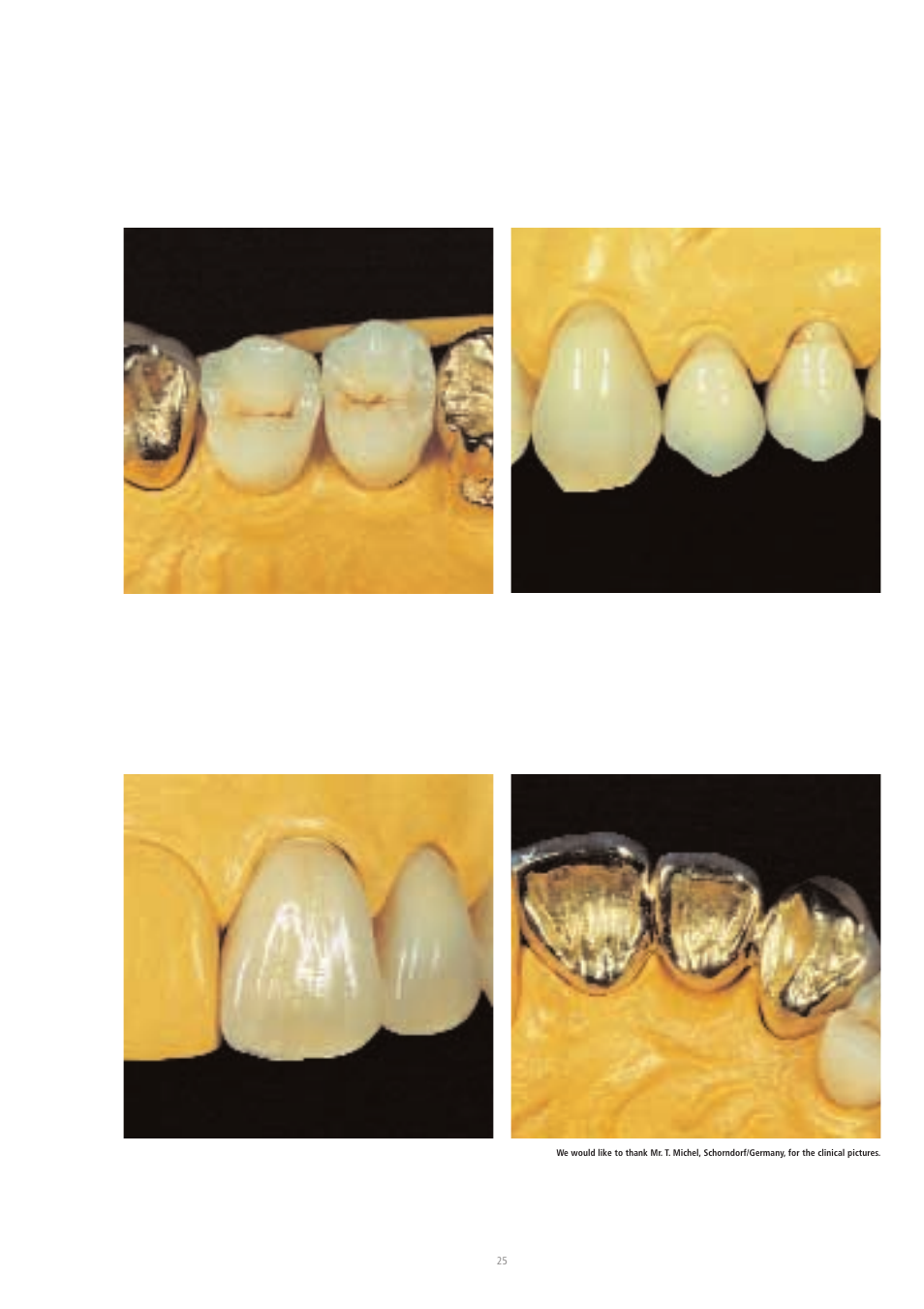 Ivoclar Vivadent SR Chromasit User Manual | Page 25 / 28