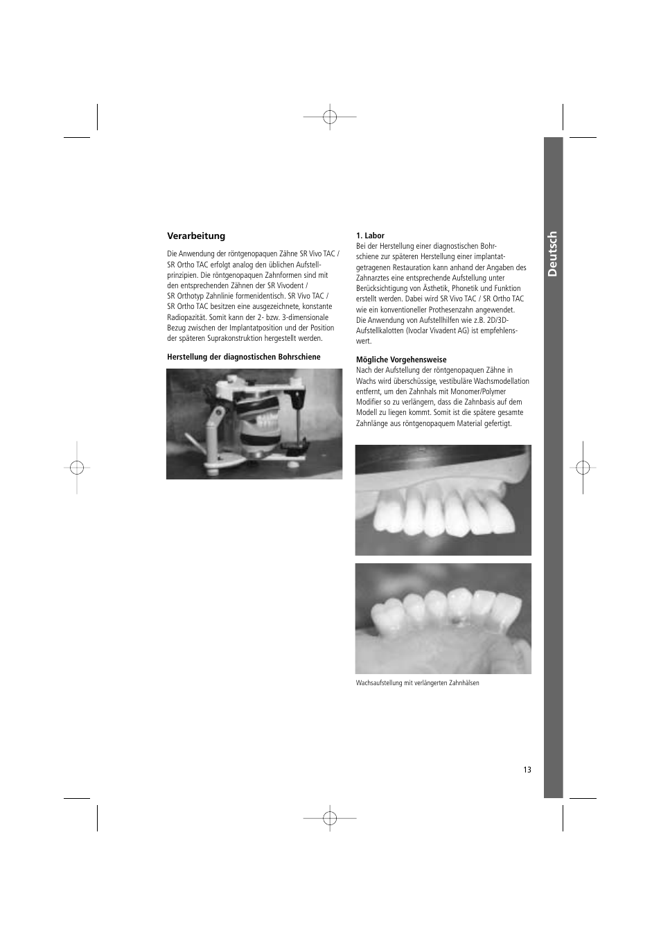 Deutsch | Ivoclar Vivadent SR Vivo TAC User Manual | Page 13 / 64