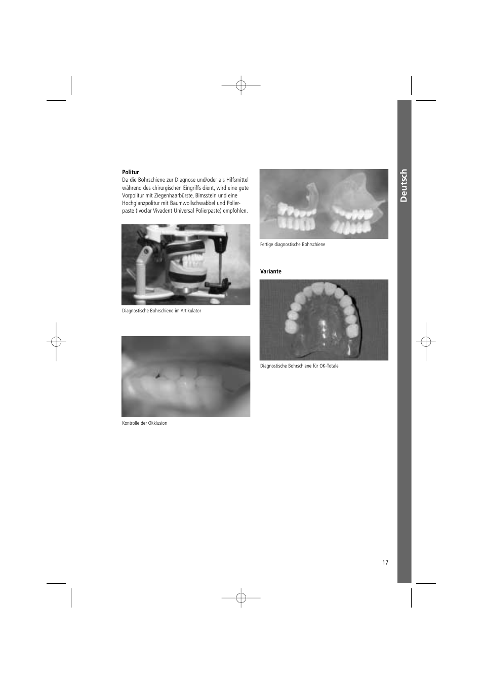 Deutsch | Ivoclar Vivadent SR Vivo TAC User Manual | Page 17 / 64