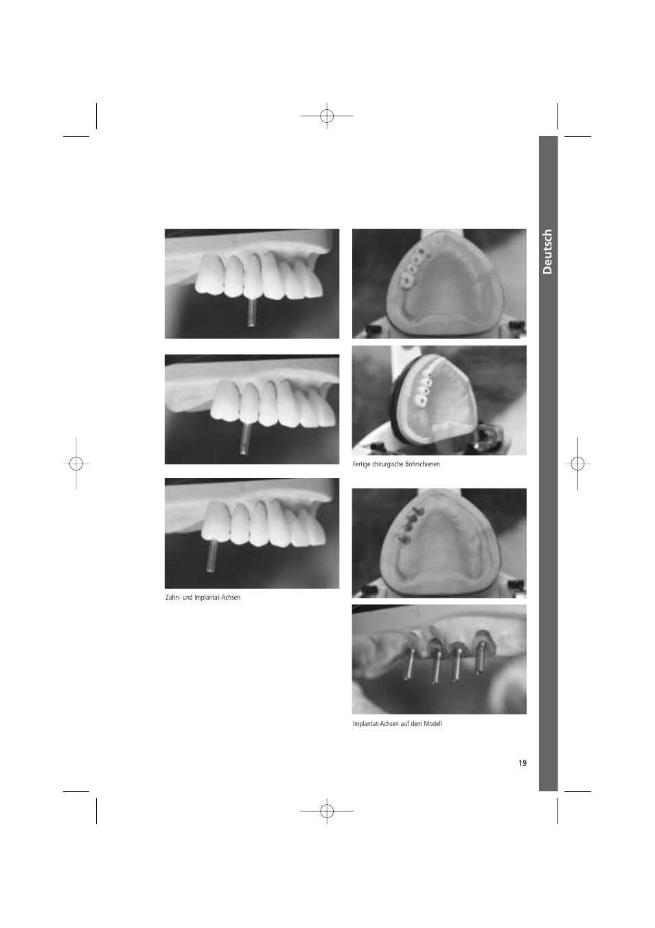 Deutsch | Ivoclar Vivadent SR Vivo TAC User Manual | Page 19 / 64