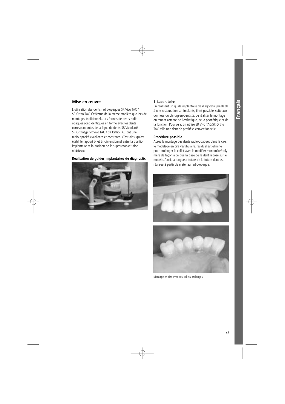 Français | Ivoclar Vivadent SR Vivo TAC User Manual | Page 23 / 64