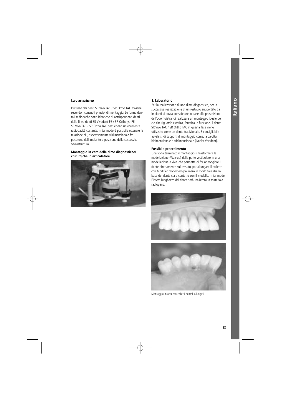 Italiano | Ivoclar Vivadent SR Vivo TAC User Manual | Page 33 / 64