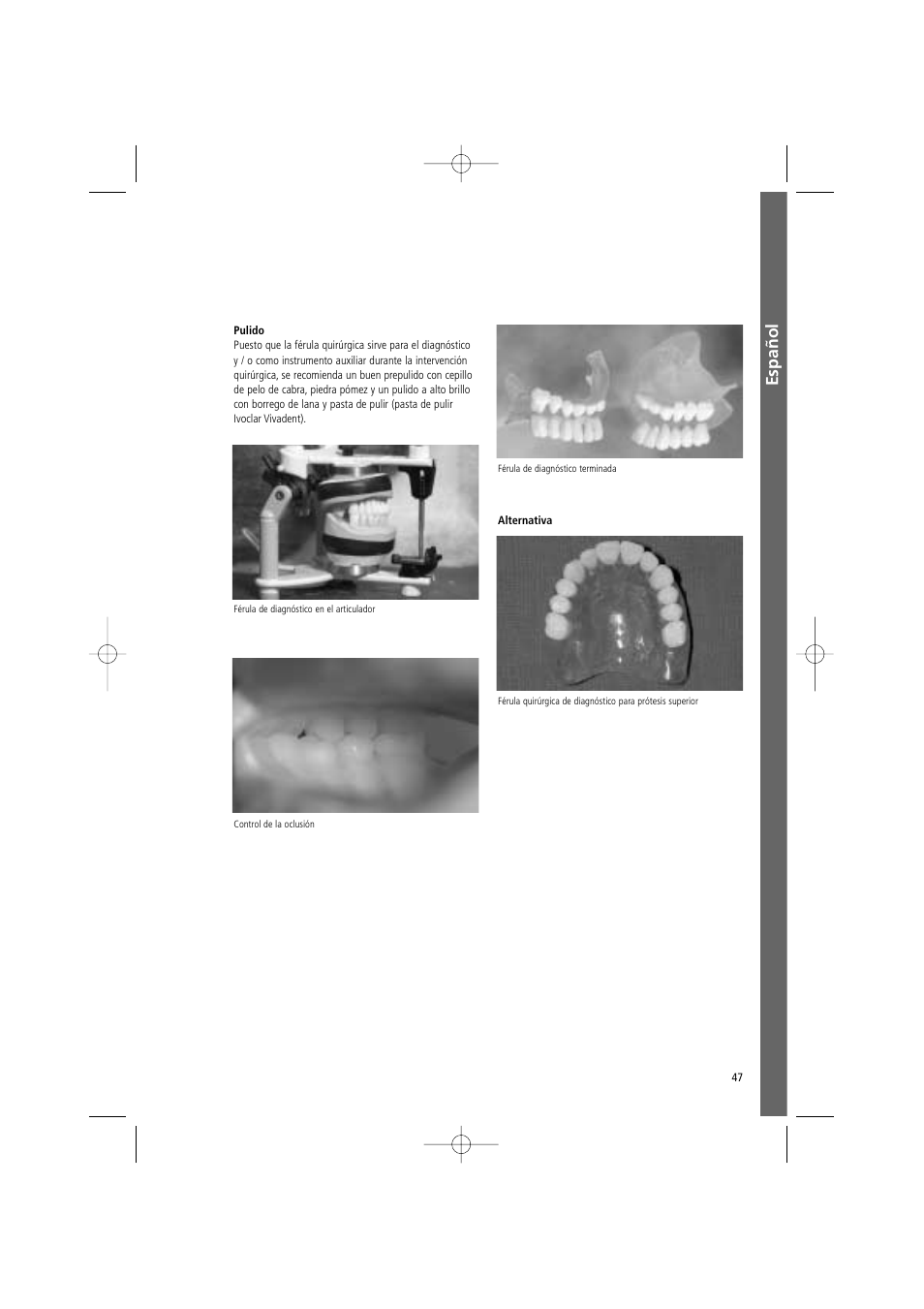 Español | Ivoclar Vivadent SR Vivo TAC User Manual | Page 47 / 64