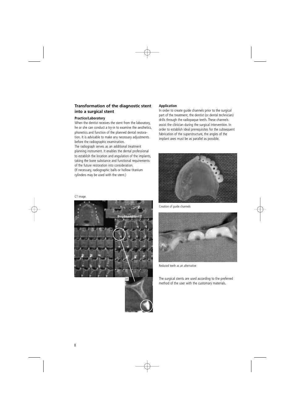 Ivoclar Vivadent SR Vivo TAC User Manual | Page 8 / 64