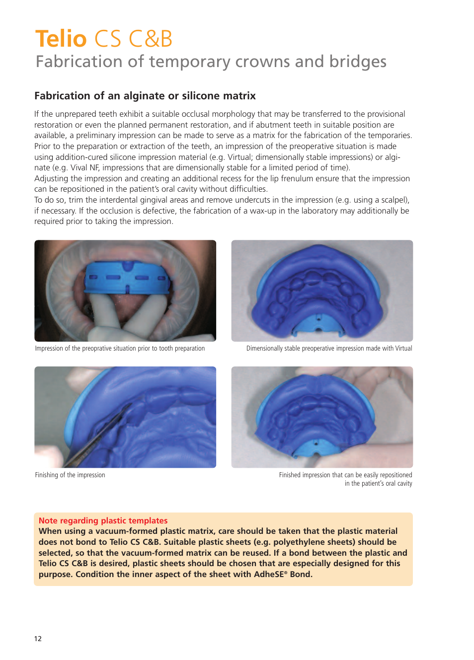 Telio cs c&b, Fabrication of temporary crowns and bridges | Ivoclar Vivadent Telio CS User Manual | Page 12 / 36