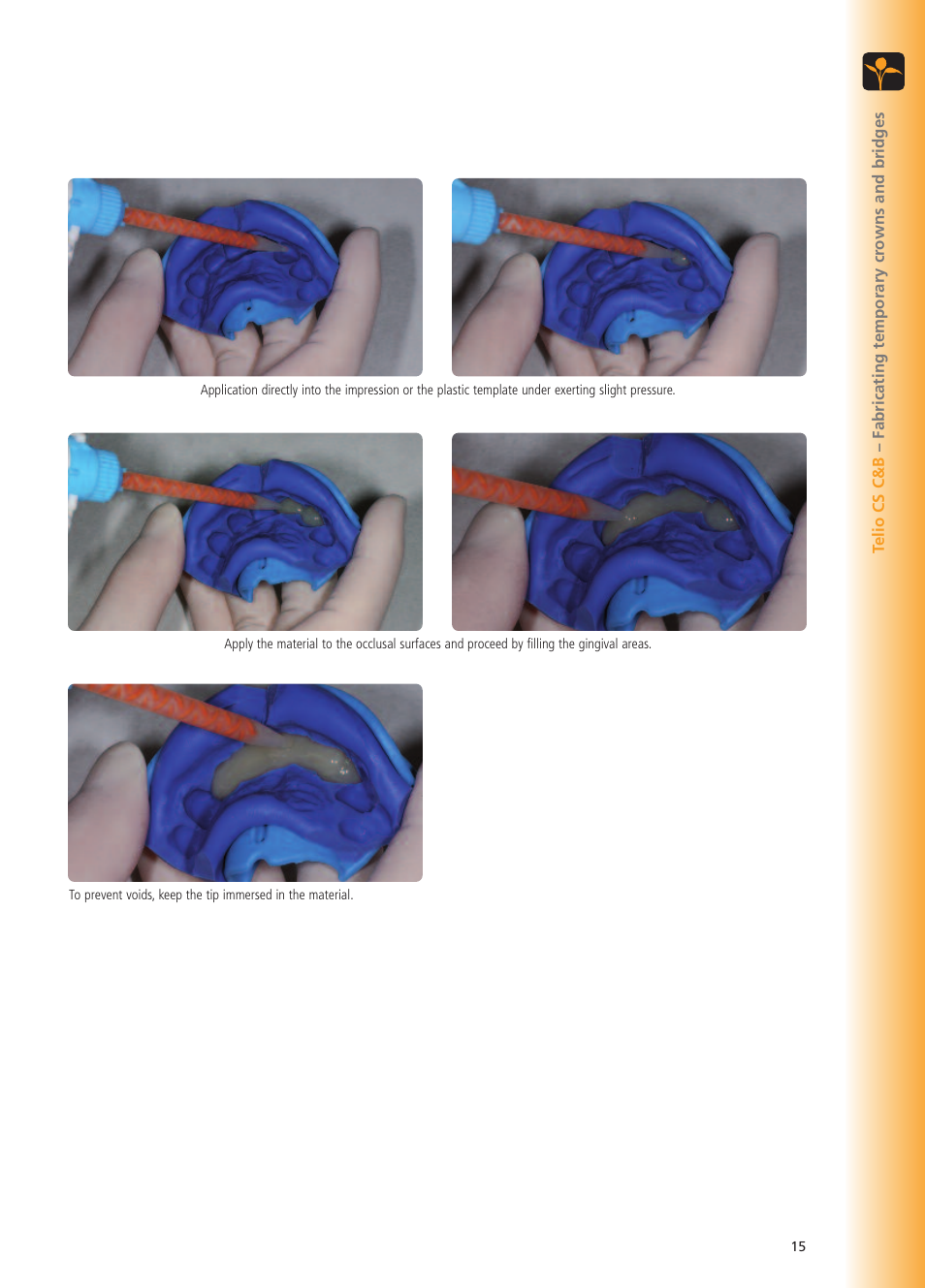 Ivoclar Vivadent Telio CS User Manual | Page 15 / 36