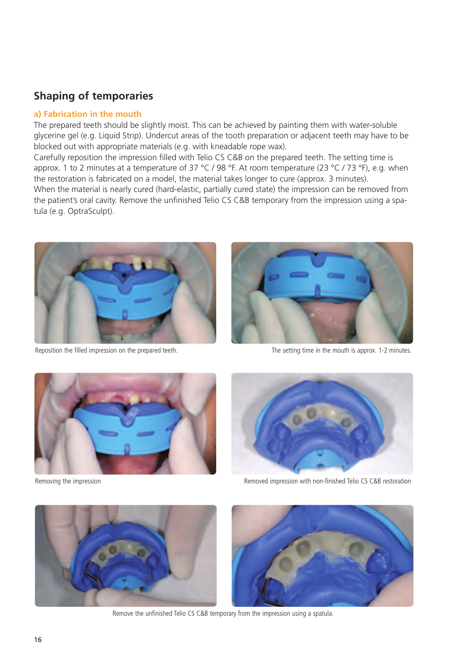 Shaping of temporaries | Ivoclar Vivadent Telio CS User Manual | Page 16 / 36