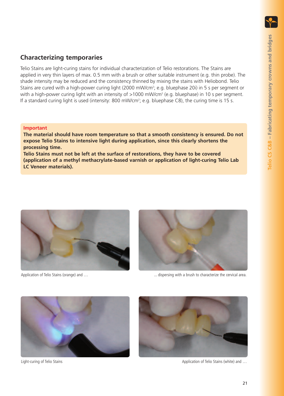Characterizing temporaries | Ivoclar Vivadent Telio CS User Manual | Page 21 / 36