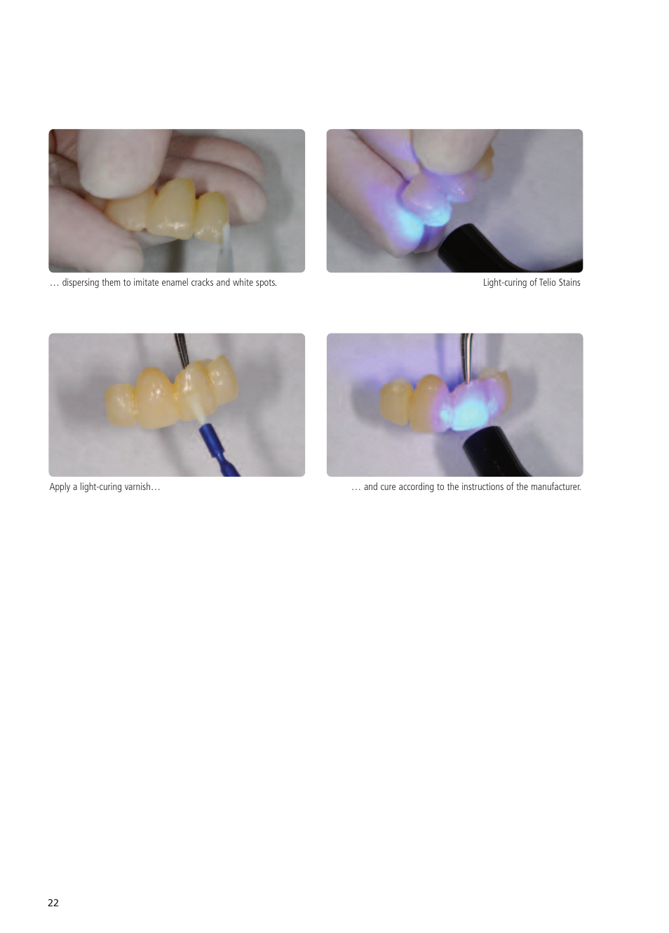 Ivoclar Vivadent Telio CS User Manual | Page 22 / 36