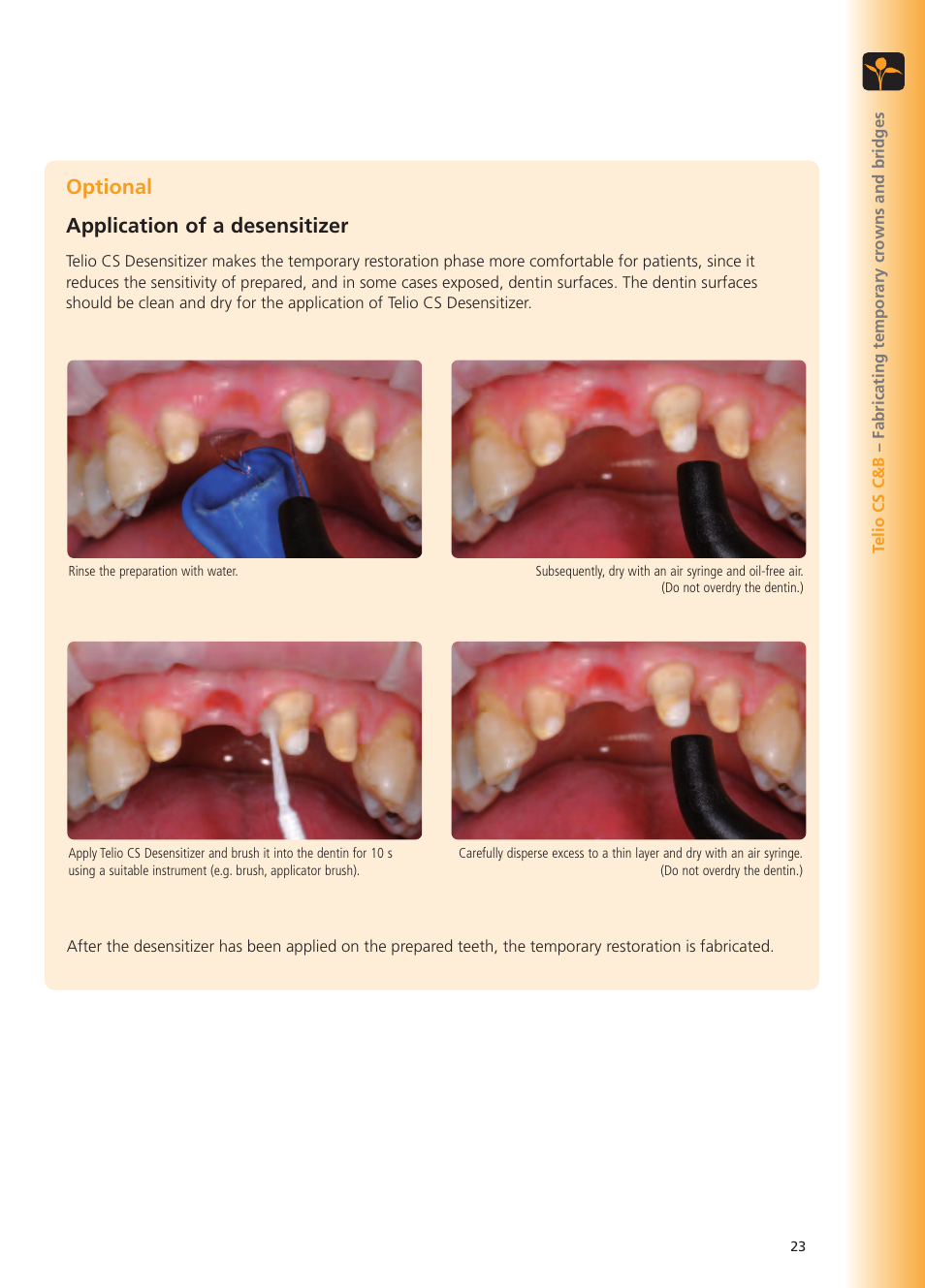 Optional application of a desensitizer | Ivoclar Vivadent Telio CS User Manual | Page 23 / 36