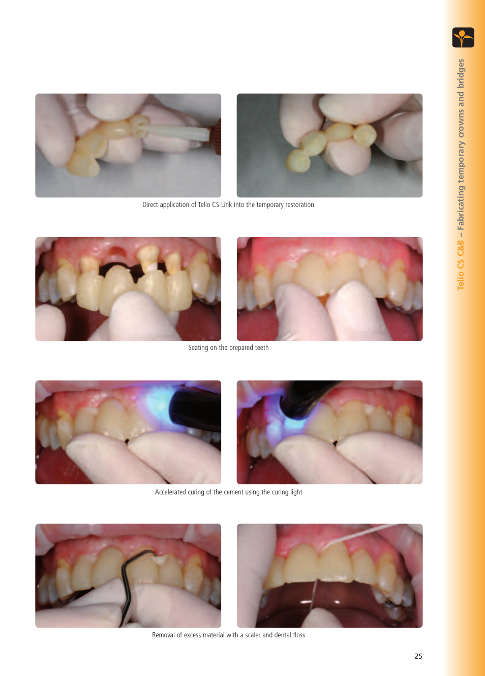 Ivoclar Vivadent Telio CS User Manual | Page 25 / 36