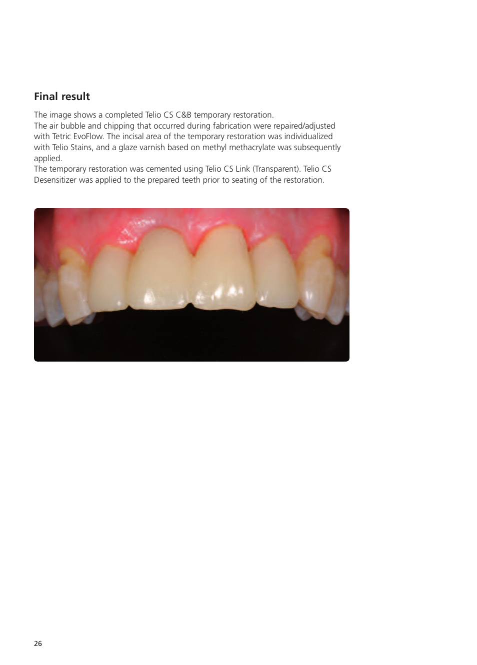 Final result | Ivoclar Vivadent Telio CS User Manual | Page 26 / 36