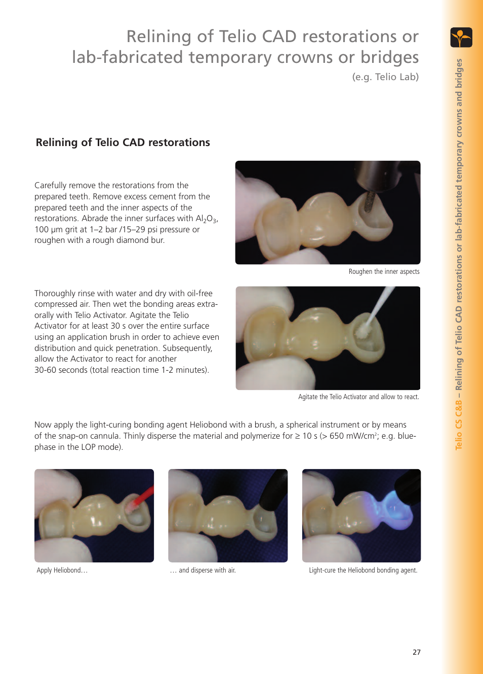 Relining of telio cad restorations | Ivoclar Vivadent Telio CS User Manual | Page 27 / 36