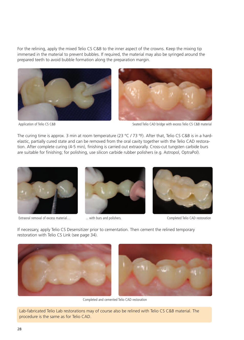 Ivoclar Vivadent Telio CS User Manual | Page 28 / 36