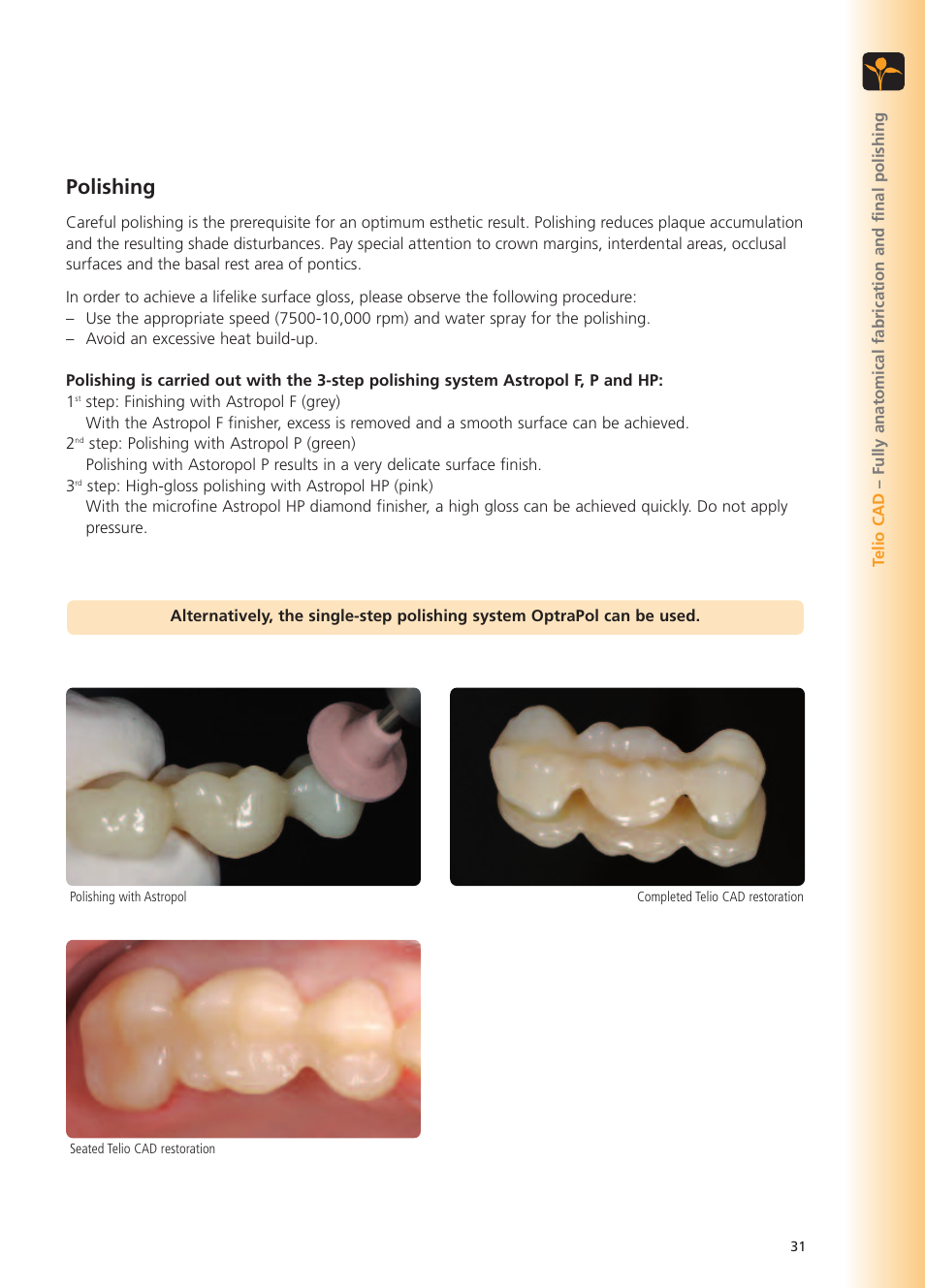 Polishing | Ivoclar Vivadent Telio CS User Manual | Page 31 / 36