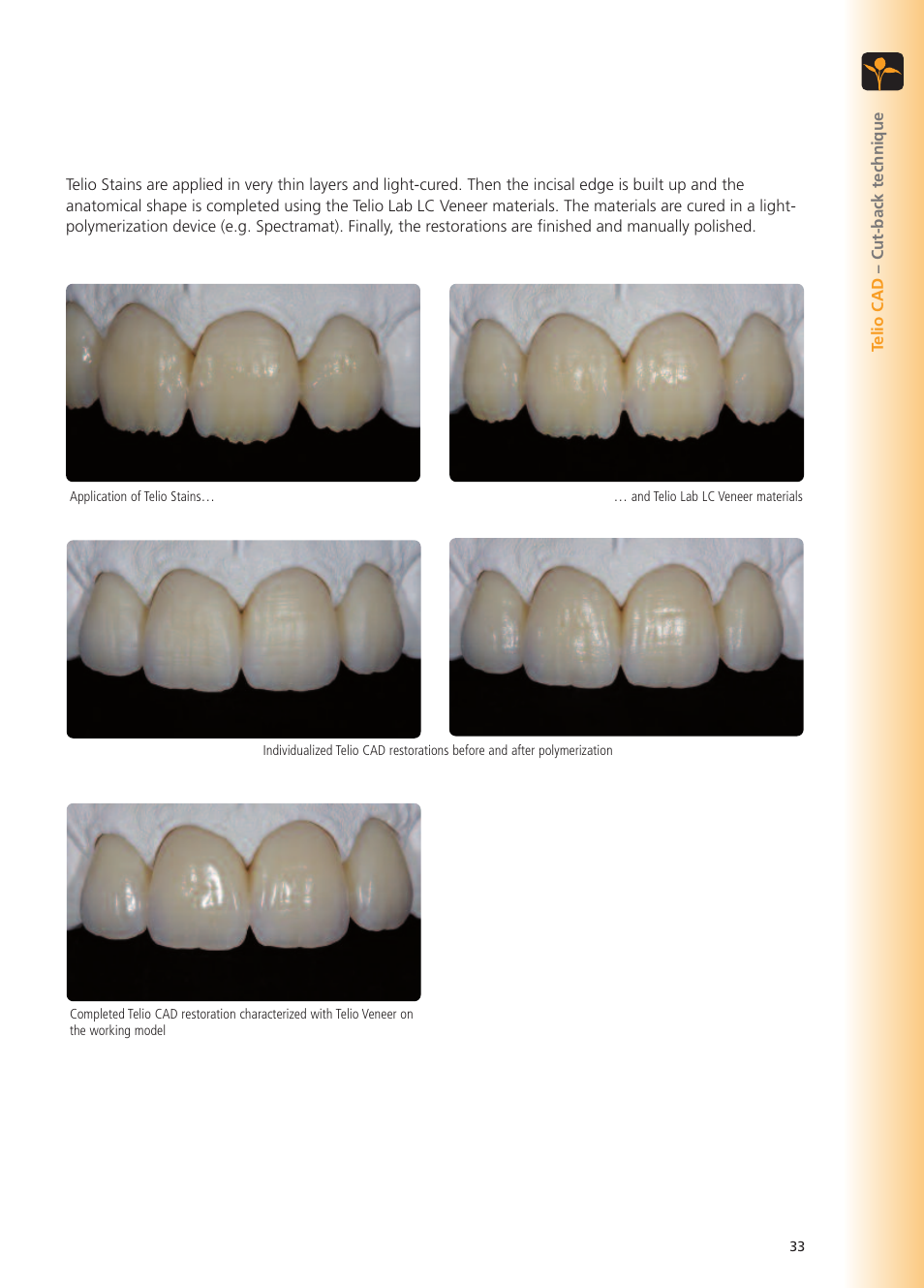 Ivoclar Vivadent Telio CS User Manual | Page 33 / 36