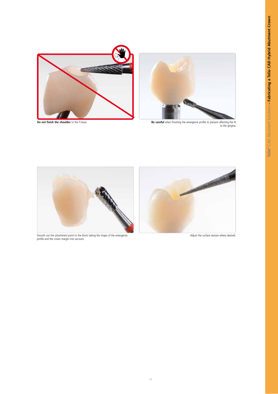 Ivoclar Vivadent Telio CAD A16 User Manual | Page 11 / 28