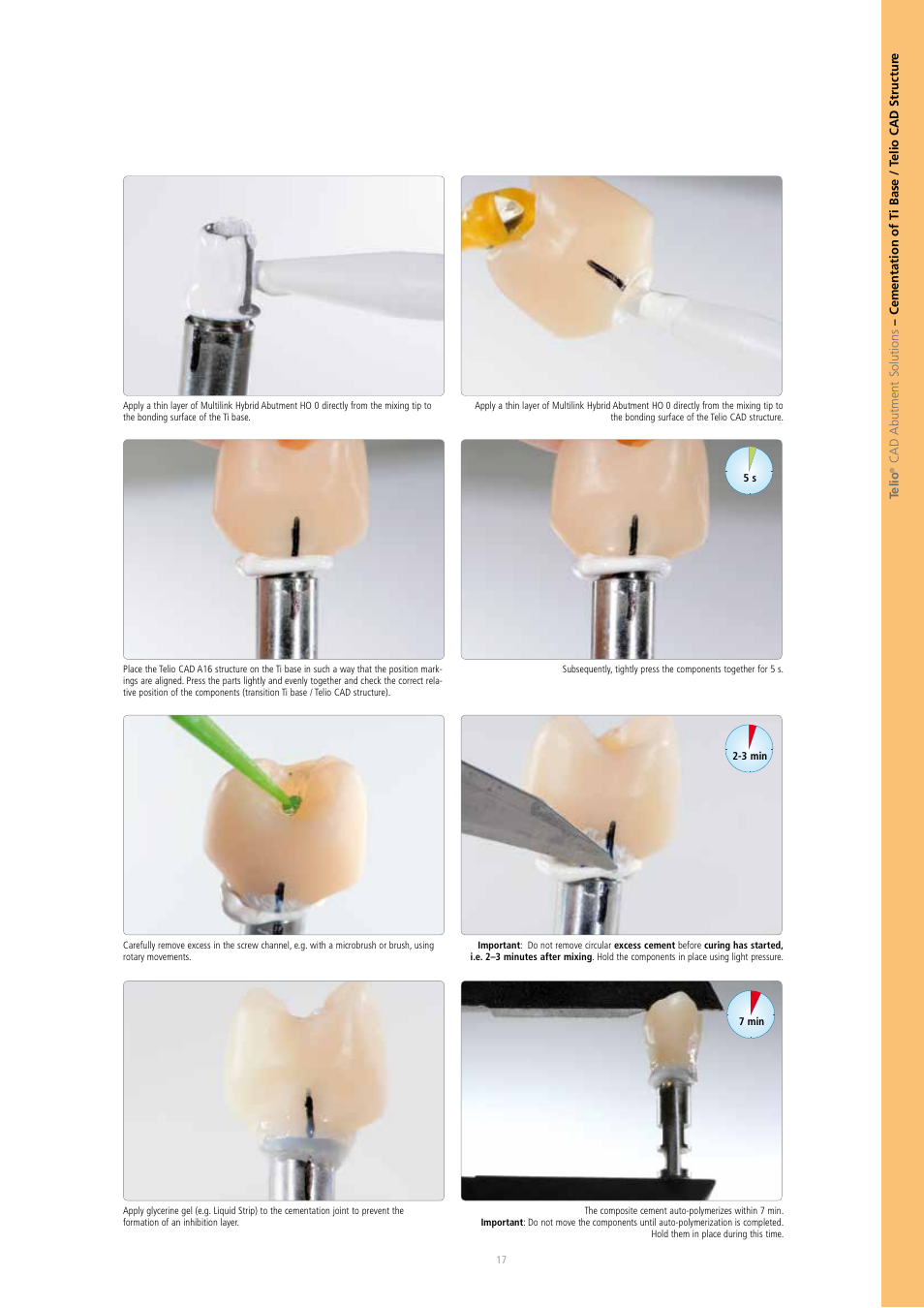 Ivoclar Vivadent Telio CAD A16 User Manual | Page 17 / 28