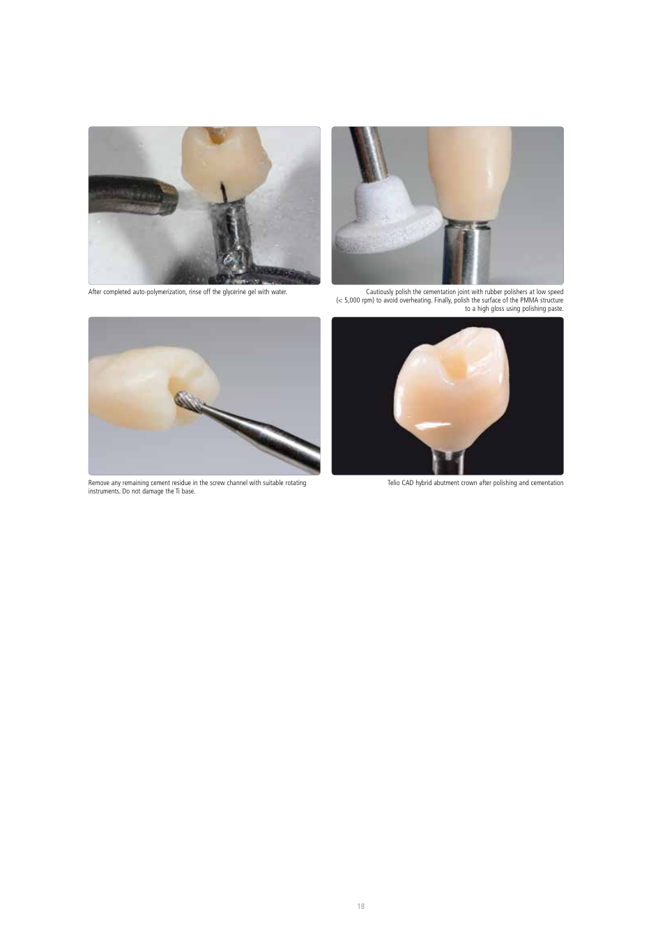 Ivoclar Vivadent Telio CAD A16 User Manual | Page 18 / 28