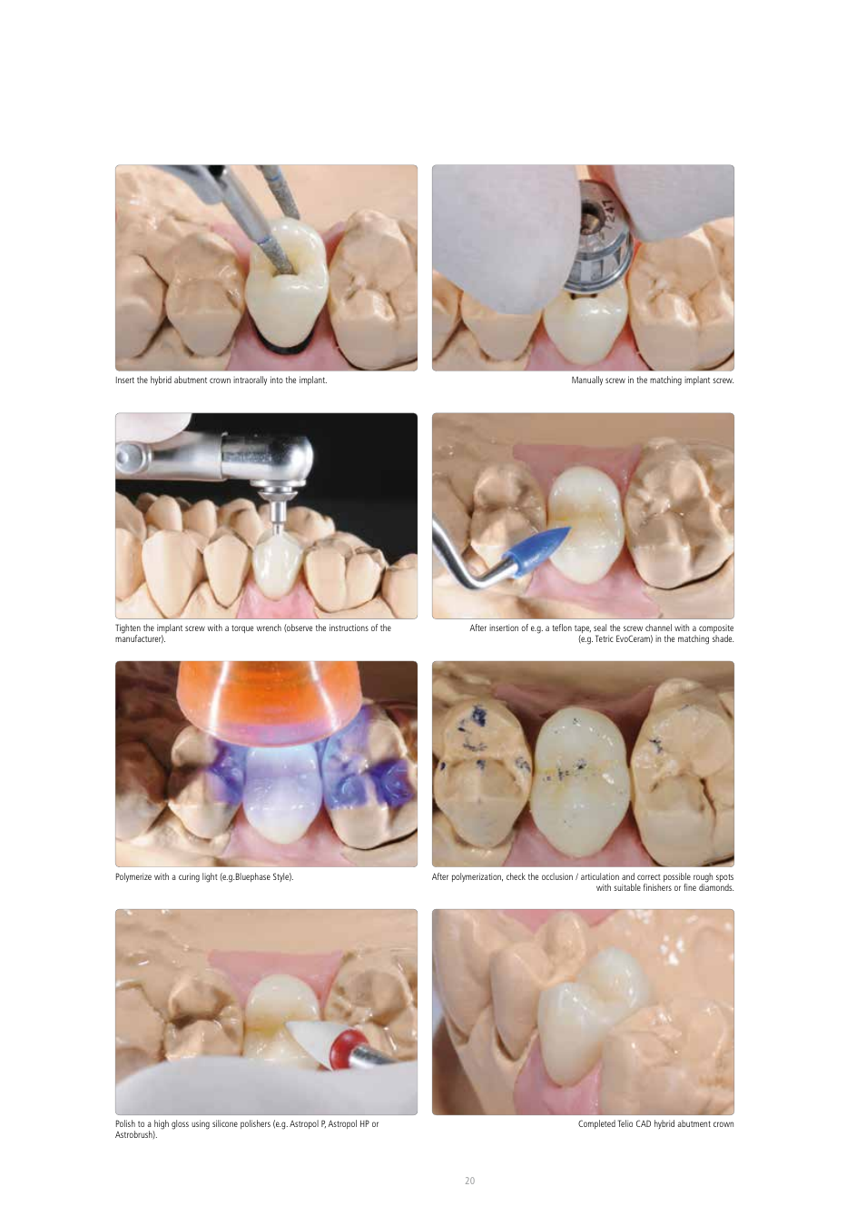 Ivoclar Vivadent Telio CAD A16 User Manual | Page 20 / 28