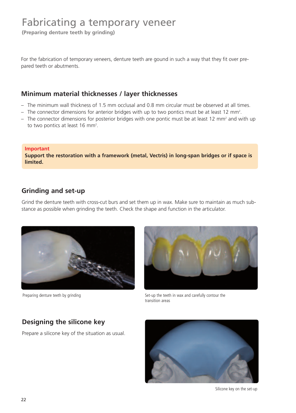 Fabricating a temporary veneer, Minimum material thicknesses / layer thicknesses, Grinding and set-up | Designing the silicone key | Ivoclar Vivadent Telio Lab User Manual | Page 22 / 48