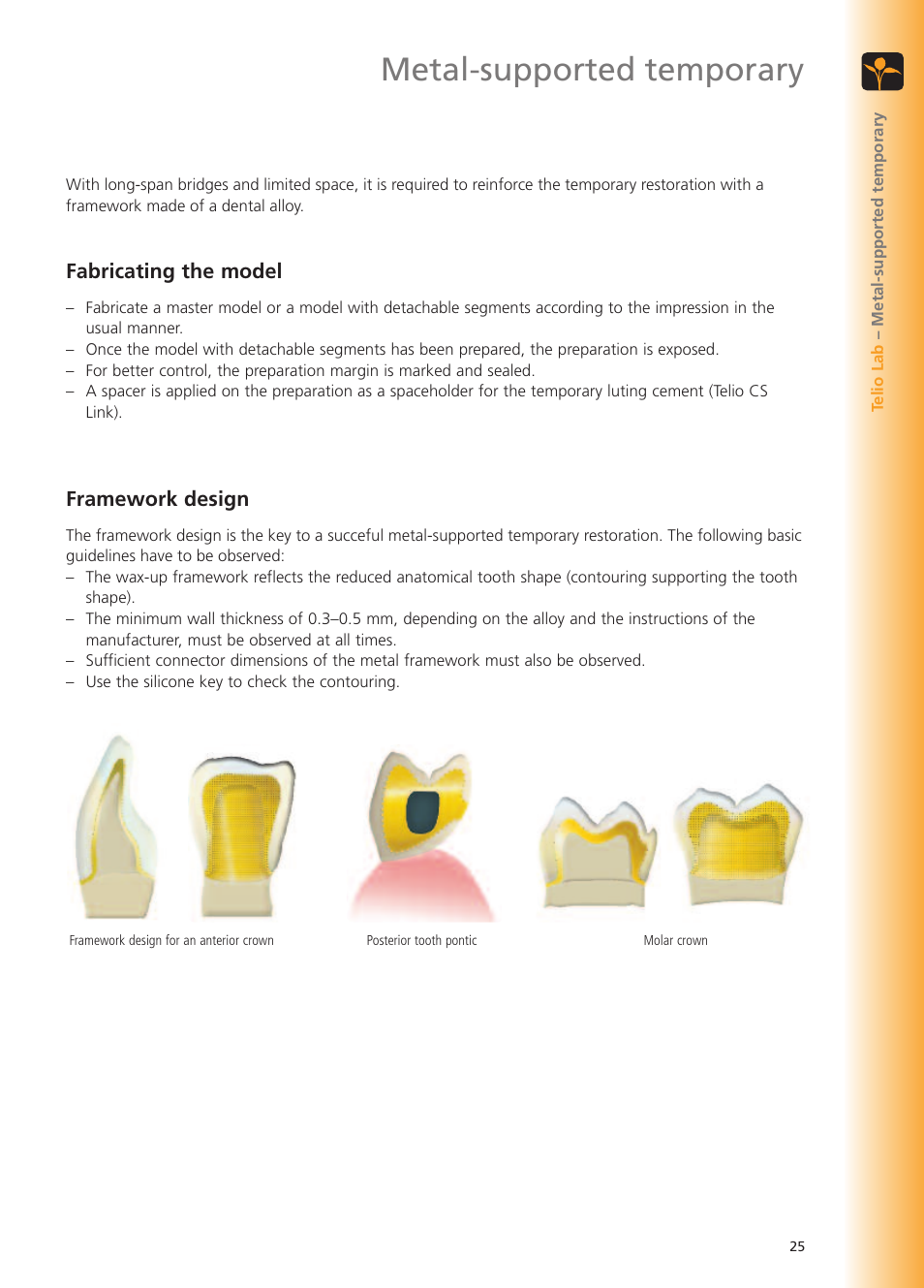 Metal-supported temporary, Fabricating the model, Framework design | Ivoclar Vivadent Telio Lab User Manual | Page 25 / 48