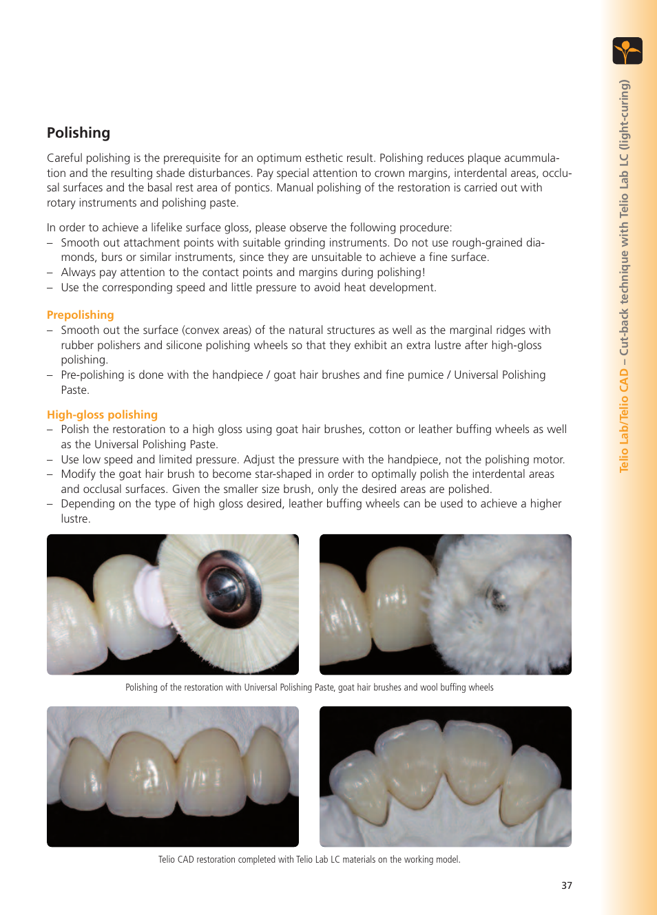 Polishing | Ivoclar Vivadent Telio Lab User Manual | Page 37 / 48