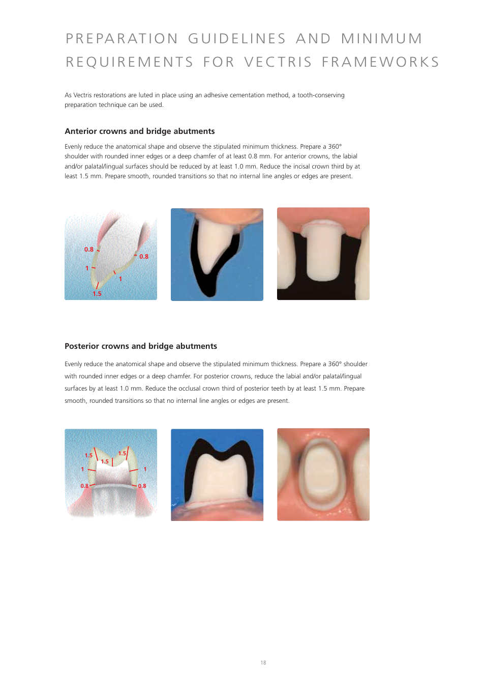 Ivoclar Vivadent Vectris User Manual | Page 18 / 60