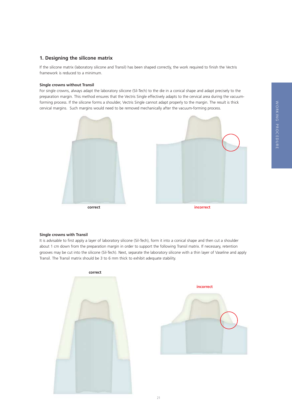 Designing the silicone matrix | Ivoclar Vivadent Vectris User Manual | Page 21 / 60