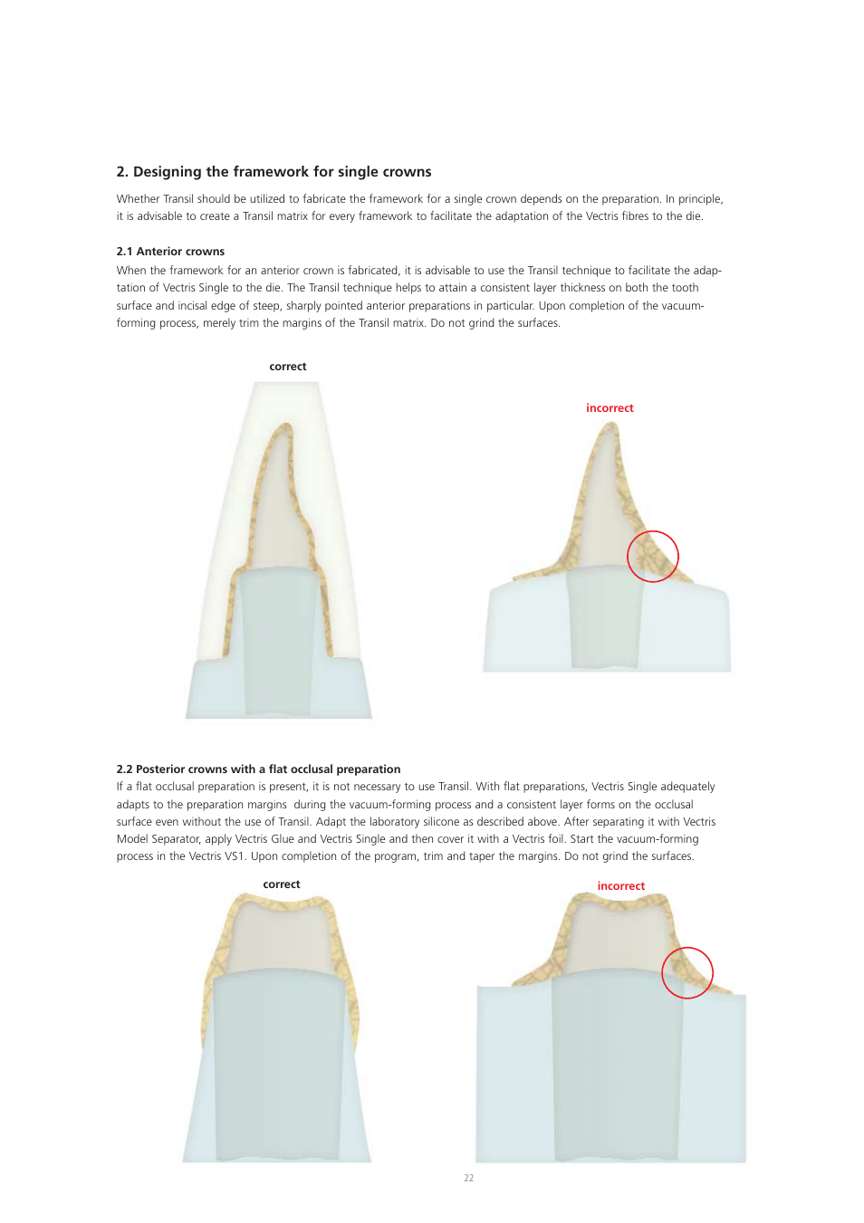 Designing the framework for single crowns | Ivoclar Vivadent Vectris User Manual | Page 22 / 60