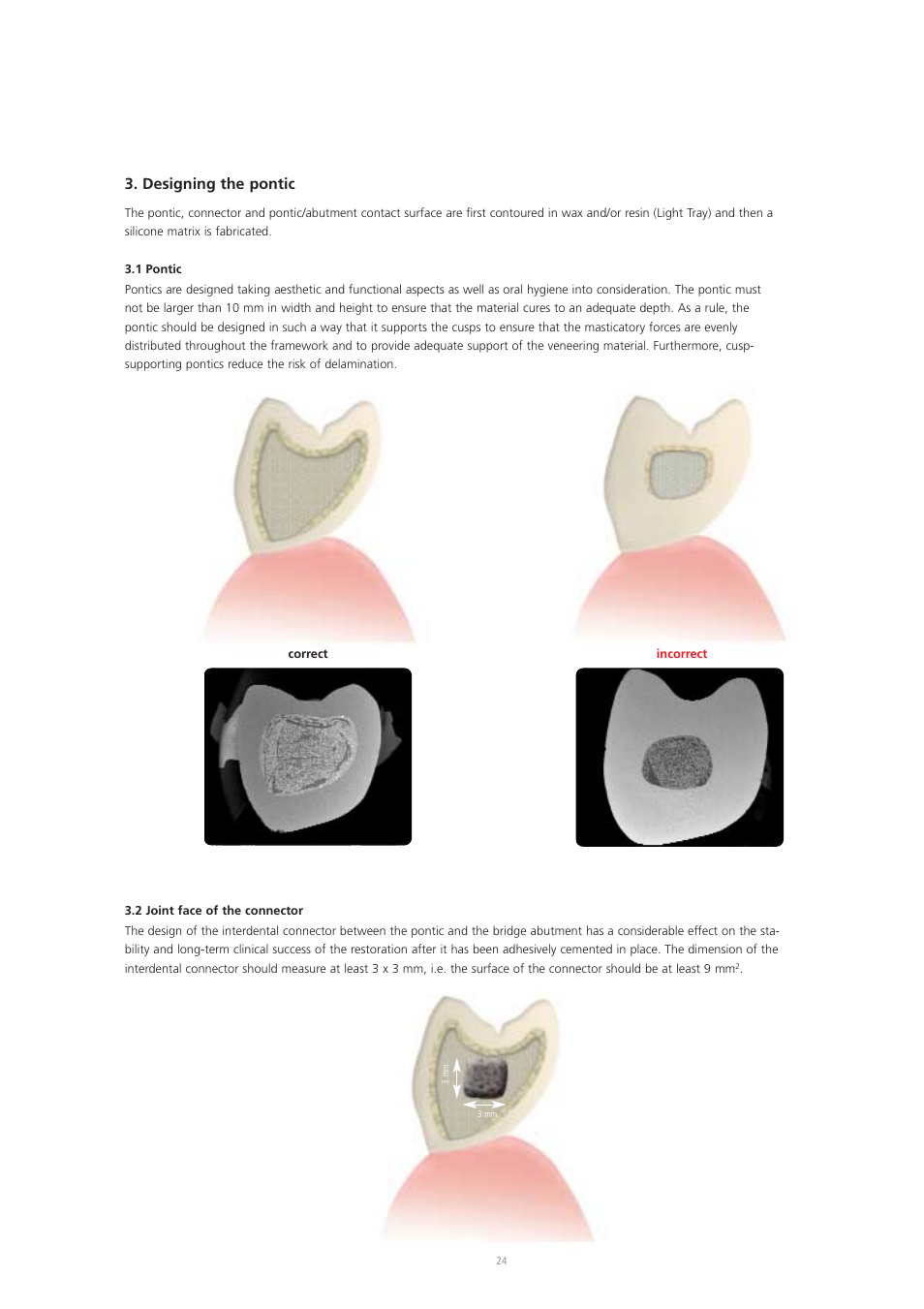 Designing the pontic | Ivoclar Vivadent Vectris User Manual | Page 24 / 60