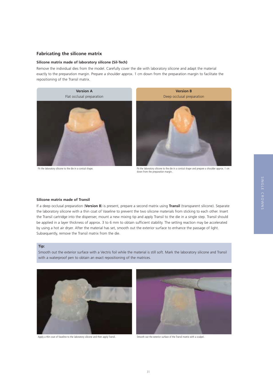 Fabricating the silicone matrix | Ivoclar Vivadent Vectris User Manual | Page 31 / 60